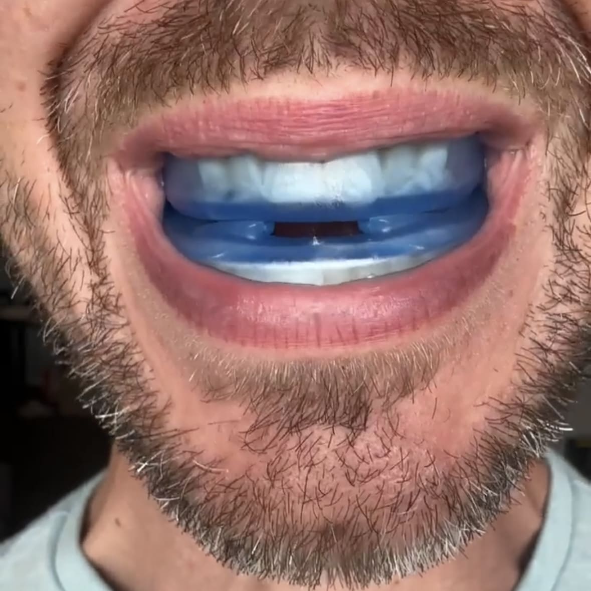 DreamGuard Sleep Solution